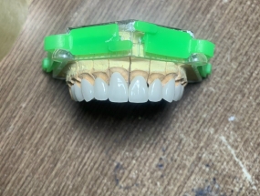 GIA CÔNG SƯỜN 1