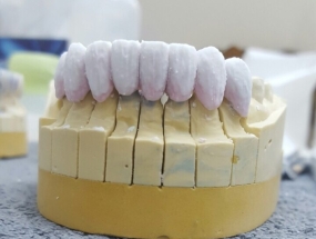 GIA CÔNG SƯỜN 4