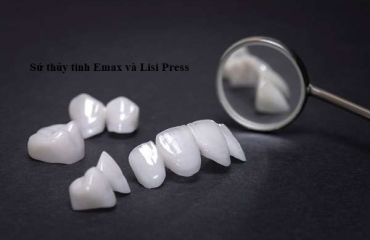 Hé lộ cách làm răng Sứ thẩm mỹ, răng toàn sứ, răng sứ kim loại hiện đại nhất Việt Nam