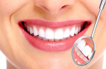 LÀM RĂNG HẾT 200 TRIỆU // Có nên làm răng sứ không? | LÀM ĐẸP | NGÔ LAN HƯƠNG